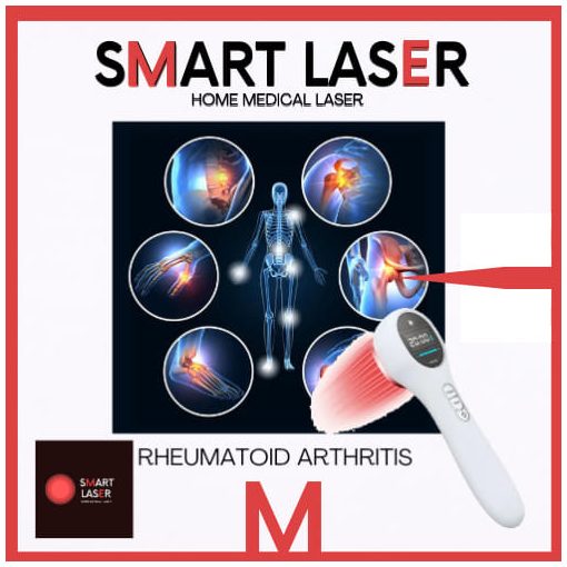 SMART LASER - Home Medical Laser 340mW - kézi lágylézer készülék - Gyógyító lézer otthoni használatra