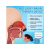   SMART LASER - Rhinitis Nasal Laser Orrkezelő lágylézer készülék 