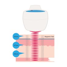 Handy Cure S' kézi lágylézer készülék - Gyógyító lézer otthoni használatra